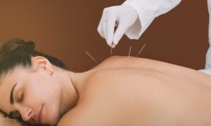 Descubre qué son los acupuntura puntos prohibidos, qué riesgos existen y consejos para después de cada sesión.
